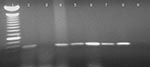 Thumbnail of Amplification of severe acute respiratory syndrome–associated coronavirus (SARS-CoV) RNA in chicken blood, using one-step and two-step reverse transcriptase–polymerase chain reaction (RT-PCR) with nucleocapsid primers. Lane 1: 100-bp ladder, the bright band representing 600 bp; Lane 2: chicken 115, 2 days postinocuation (dpi), one-step RT-PCR; lane 3: chicken 115, 2 dpi, two-step RT-PCR (detecting negative-strand RNA); lane 4: chicken 117, 3 dpi, one-step RT-PCR; lane 5: chicken 117