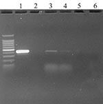 Thumbnail of Ethidium bromide stained agarose gel of ORF 1b standard reverse transcription–polymerase chain reaction (RT-PCR) products from oropharyngeal swabs of two chickens day 1 after injection. Key: 1) Positive control (severe acute respiratory syndrome coronavirus from Vero E6 culture); 2) Negative control (water); 3) and 4) Oropharyngeal swabs from chickens 337 and 341 at 1 days after injection; 5) Cloacal swab from turkey at day 2 after injection; and 6) Negative control from cloacal swa