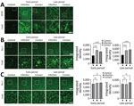 SARS-CoV-2 induces activation of microglial cells in the brain white matter in a region-specific manner in SARS-CoV-2–infected and contact dogs in study of the neurologic effects of SARS-CoV-2 transmitted among dogs. A) Representative fluorescent images of glial fibrillary acidic protein (activation astrocyte marker, green) staining of canine brain sections derived from SARS-CoV-2–infected and contact groups at early and late days after infection. Scale bars indicate 200 μm; in insets, 50 μm. B) Representative fluorescent images and statistical results of Iba-1 (a marker of microglia; green) staining of canine brain white matter sections derived from SARS-CoV-2–infected and contact dogs at early and late dpi. Scale bars indicate 200 μm; in insets, 50 μm. C) Representative fluorescent images and statistical results of Iba-1 (a marker of microglia, green) staining of canine brain gray matter sections derived from SARS-CoV-2–infected and contact dogs at early and late dpi. Scale bars indicate 200 μm; in insets, 50 μm. Statistical significance was determined using a 1-way analysis of variance. Data in graphs are presented as means ±SEM.